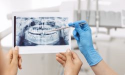 Ακτινολογικό Τμήμα Οδοντιατρείου Μπόσνα στην Αριδαία Πέλλας